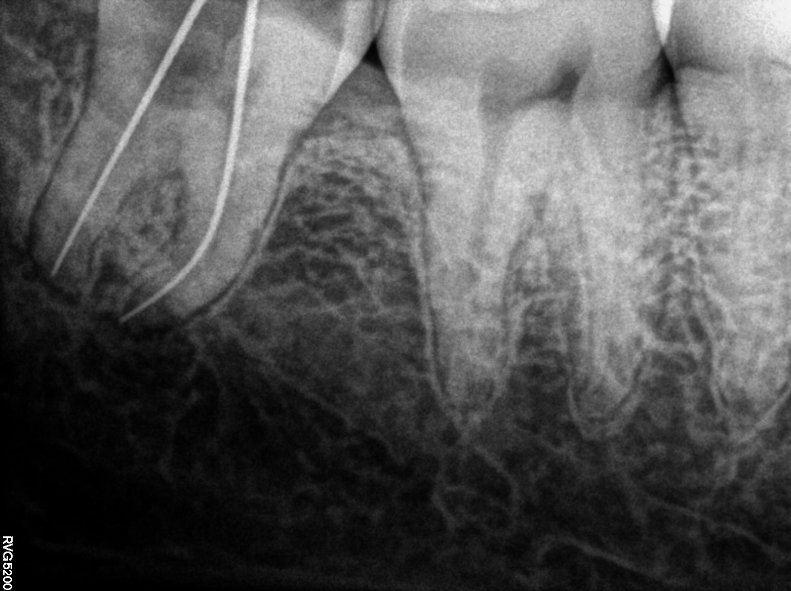 Dental X-ray
